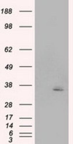 PIM2 Mouse anti-Human, Clone: OTI8B4, lyophilized, TrueMAB 100 &mu;g | Buy Online | Origene Technologies | Fisher Scientific