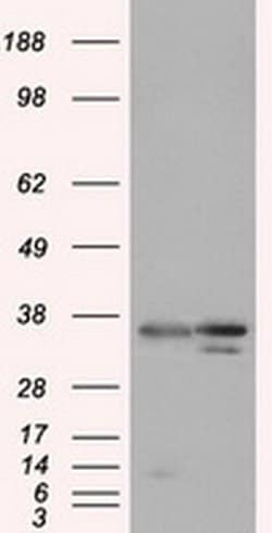 PIM2 Monoclonal Antibody (OTI10A12), TrueMAB , OriGene 30 &mu;L; Unconjugated:Antibodies,