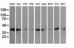 PIM2 Monoclonal Antibody (OTI10A12), TrueMAB , OriGene 30 &mu;L; Unconjugated:Antibodies,