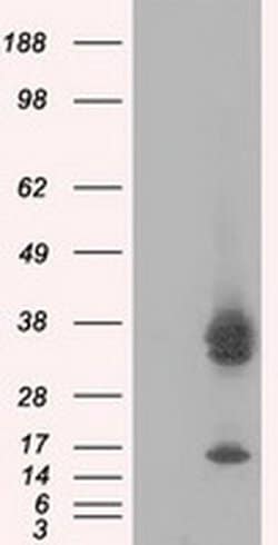 PIM2 Monoclonal Antibody (OTI8H10), TrueMAB , OriGene 30 &mu;L; Unconjugated:Antibodies,