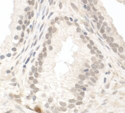 PIMT Rabbit anti-Human, Polyclonal, Bethyl Laboratories 10 &mu;l; Unlabeled:Antibodies,
