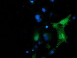 PIP4K2A Monoclonal Antibody (OTI1B2), TrueMAB , OriGene 100 &mu;L; Unconjugated:Antibodies,