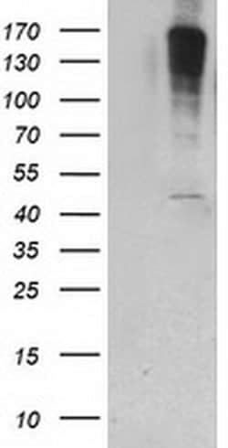PIP4K2A Monoclonal Antibody (OTI1B2), TrueMAB , OriGene 100 &mu;L; Unconjugated:Antibodies,