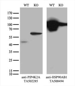 PIP4K2A Monoclonal Antibody (OTI1B2), TrueMAB , OriGene 100 &mu;L; Unconjugated:Antibodies,