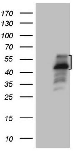 PISD Monoclonal Antibody (OTI2C1), TrueMAB , OriGene 100 &mu;L; Unconjugated:Antibodies,