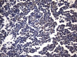PITPNB Monoclonal Antibody (OTI6H10), TrueMAB , OriGene 100 &mu;L; Unconjugated:Antibodies,