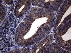 PITPNB Monoclonal Antibody (OTI5D11), TrueMAB , OriGene 100 &mu;L; Unconjugated:Antibodies,