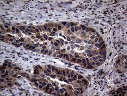 PITPNB Mouse anti-Human, Clone: OTI5D11, lyophilized, TrueMAB 100 &mu;g;