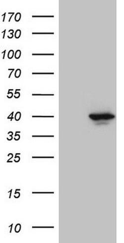 PITPNB Mouse anti-Human, Clone: OTI6H10, lyophilized, TrueMAB 100 &mu;g;