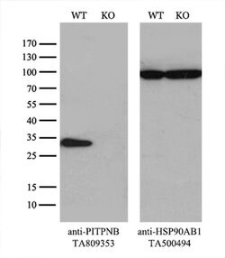 PITPNB Monoclonal Antibody (OTI4A7), TrueMAB , OriGene 100 &mu;L; Unconjugated:Antibodies,