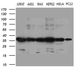 PITPNB Monoclonal Antibody (OTI4A7), TrueMAB , OriGene 100 &mu;L; Unconjugated:Antibodies,