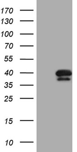 PITPNB Mouse anti-Human, Clone: OTI5D11, lyophilized, TrueMAB 100 &mu;g;