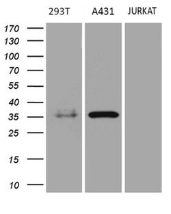 PITPNB Monoclonal Antibody (OTI5D11), TrueMAB , OriGene 100 &mu;L; Unconjugated:Antibodies,