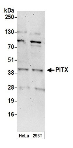 PITX1 Rabbit anti-Human, Polyclonal, Bethyl Laboratories 100 &mu;L; Unconjugated:Antibodies,