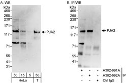 PJA2 Rabbit anti-Human, Polyclonal, Bethyl Laboratories 100 &mu;L; Unconjugated:Antibodies,