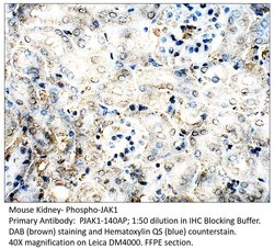 Phospho-JAK1 (Tyr1034, Tyr1035) Rabbit anti-Human, Mouse, Rat, Polyclonal,