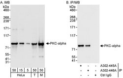 PKC-alpha Rabbit anti-Human, Mouse, Polyclonal, Bethyl Laboratories 100