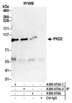 PKD2 Rabbit anti-Human, Polyclonal, Bethyl Laboratories 100 &mu;L; Unconjugated:Antibodies,