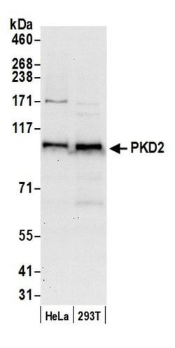 PKD2 Polyclonal Antibody, Bethyl Laboratories 20 &mu;L; Unconjugated:Antibodies,