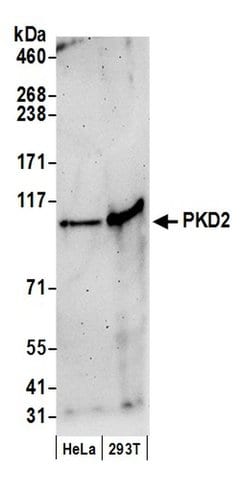 PKD2 Polyclonal Antibody, Bethyl Laboratories 20 &mu;l; Unlabeled:Antibodies,