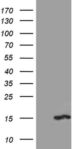 PKIA Mouse anti-Human, Clone: OTI1G5, TrueMAB , Origene 30 &mu;L; Unconjugated:Antibodies,