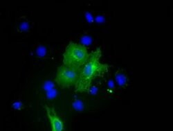 PKLR Monoclonal Antibody (OTI1H9), TrueMAB , OriGene 100 &mu;L; Unconjugated:Antibodies,