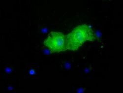 PKLR Monoclonal Antibody (OTI1H2), TrueMAB , OriGene 30 &mu;L; Unconjugated:Antibodies,