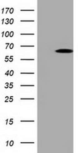 PKLR Monoclonal Antibody (OTI1A5), TrueMAB , OriGene 100 &mu;L; Unconjugated:Antibodies,
