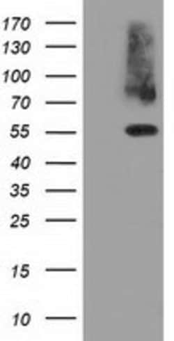PKLR Mouse anti-Human, Clone: OTI1G9, lyophilized, TrueMAB 100 &mu;g; Unconjugated:Antibodies,