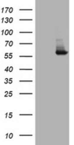 PKM1 Mouse anti-Human, Clone: OTI4E8, lyophilized, TrueMAB 100 &mu;g; Unconjugated:Anticuerpos