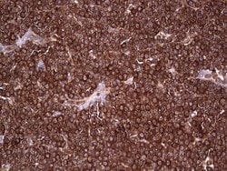 PKM2 Mouse anti-Human, Clone: OTI12D5, liquid, TrueMAB 100 &mu;L; Unconjugated:Antibodies,