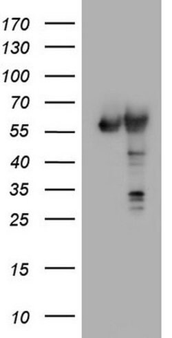 PKM2 Mouse anti-Human, Clone: OTI12D5, liquid, TrueMAB 100 &mu;L; Unconjugated:Antibodies,
