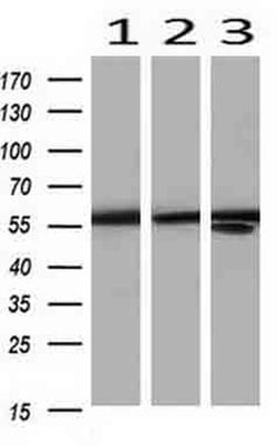 PKM2 Mouse anti-Human, Clone: OTI12D5, liquid, TrueMAB 100 &mu;L; Unconjugated:Antibodies,