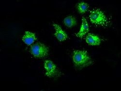 PKMYT1 Mouse anti-Human, Clone: OTI2B4, lyophilized, TrueMAB 100 &mu;g;