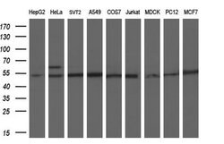 PKMYT1 Mouse anti-Human, Clone: OTI2B4, lyophilized, TrueMAB 100 &mu;g;