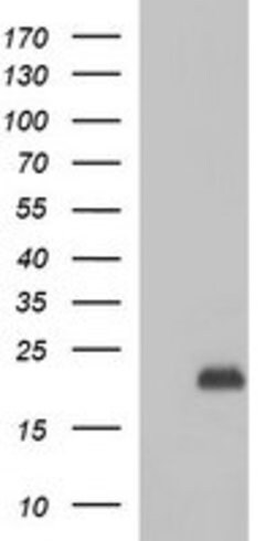 PLA2G16 Mouse anti-Human, Clone: OTI1H1, lyophilized, TrueMAB 100 &mu;g;