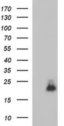 PLA2G16 Monoclonal Antibody (OTI1F5), TrueMAB , OriGene 100 &mu;L; Unconjugated:Antibodies,