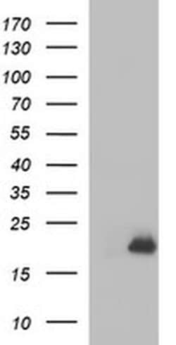 PLA2G16 Monoclonal Antibody (OTI1E9), TrueMAB , OriGene:Antibodies:Primary