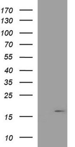 PLA2G16 Mouse anti-Human, Clone: OTI1G1, lyophilized, TrueMAB 100 &mu;g;