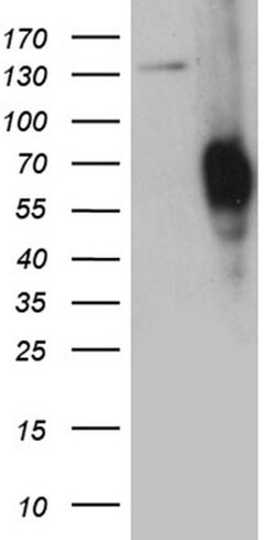 PLA2G3 Monoclonal Antibody (OTI1F4), TrueMAB , OriGene:Antibodies:Primary