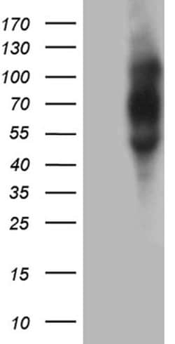 PLA2G3 Mouse anti-Human, Clone: OTI4F2, lyophilized, TrueMAB 100 &mu;g;