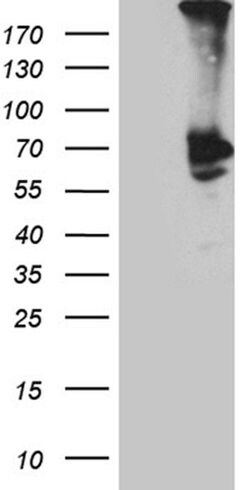 PLA2G3 Monoclonal Antibody (OTI8G8), TrueMAB , OriGene:Antibodies:Primary