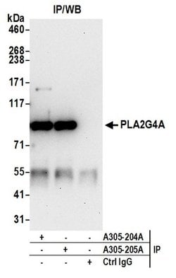 PLA2G4A/cPLA2 Rabbit anti-Human, Polyclonal, Bethyl Laboratories 10 &mu;L;