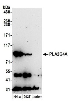 PLA2G4A/cPLA2 Polyclonal Antibody, Bethyl Laboratories 20 &mu;L; Unconjugated:Antibodies,