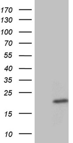 PLAC2 Mouse anti-Human, Clone: OTI6G4, lyophilized, TrueMAB 100 &mu;g;