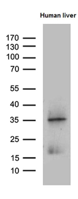 PLAC8 Mouse anti-Human, Clone: OTI2E10, lyophilized, TrueMAB 100 &mu;g;
