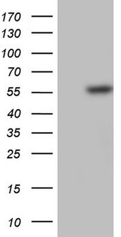 PLAU Monoclonal Antibody (OTI6H1), TrueMAB , OriGene 30 &mu;L; Unconjugated:Antibodies,