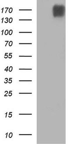 PLB1 Monoclonal Antibody (OTI1B3), TrueMAB , OriGene 100 &mu;L; Unconjugated:Antibodies,