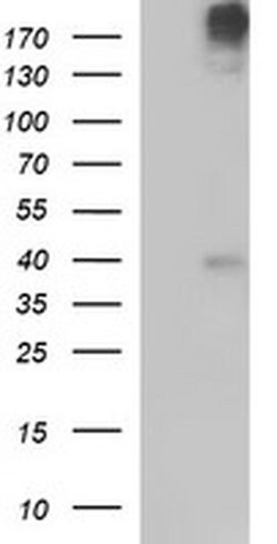 PLB1 Monoclonal Antibody (OTI1D3), TrueMAB , OriGene 100 &mu;L; Unconjugated:Antibodies,