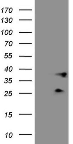 PLCXD1 Monoclonal Antibody (OTI9D4), TrueMAB , OriGene 100 &mu;L; Unconjugated:Antibodies,